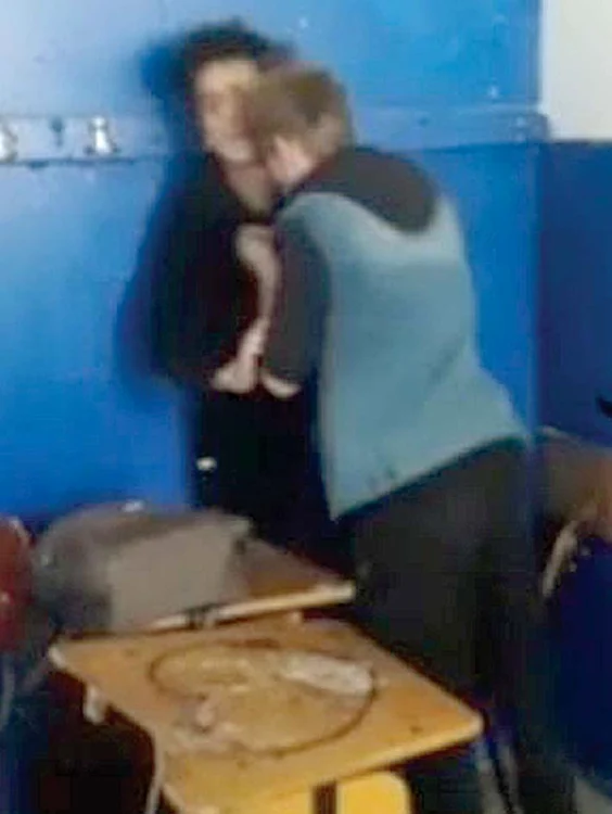 Unul dintre băieţi şi-a lovit  colegul cu capul în gură