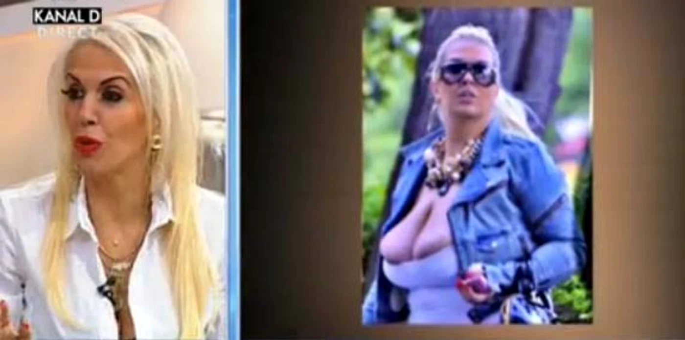 
    Raluca Bădulescu a slăbit 65 de kilograme după ce şi-a micşorat stomaculFoto: Captură Kanal D  