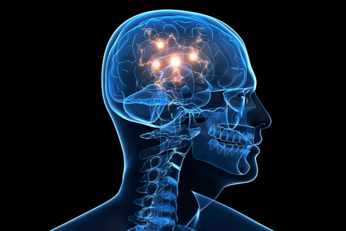 Atacul vascular cerebral poate să nu aibă semne evidente