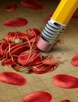 Atentie la cheagurile de sange  Sursa foto Shutterstock jpg