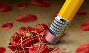Atentie la cheagurile de sange  Sursa foto Shutterstock jpg