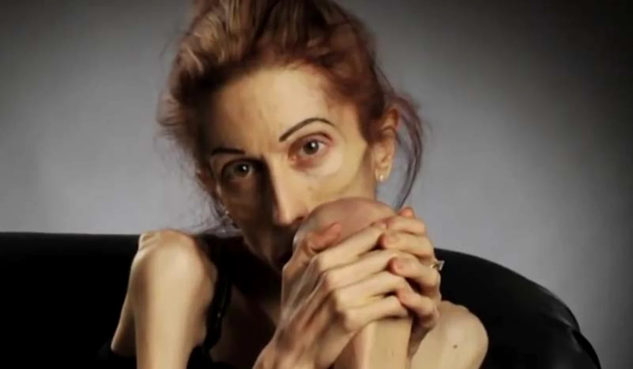 
    În prezent, Rachel luptă să supravieţuiască Foto: Captură Youtube  