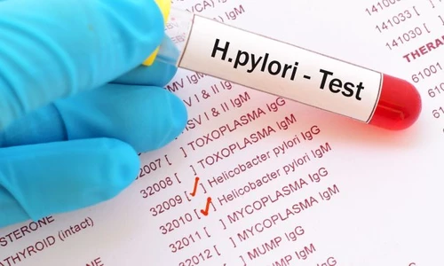 1 shutterstock 750961489 jpg jpeg