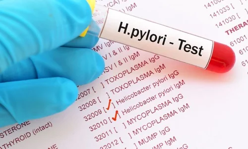 1 shutterstock 750961489 jpg jpeg