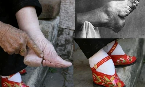 Istoricul unui ideal de frumusețe de o cruzime barbară: foot binding, practica legării picioarelor în China jpeg
