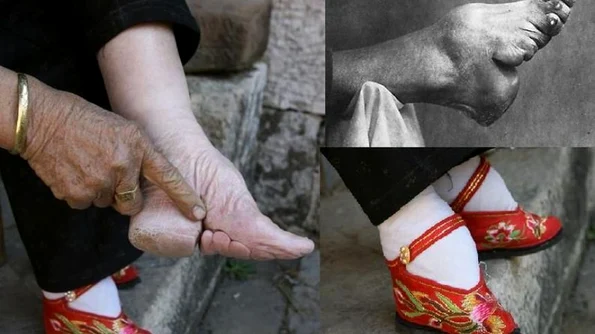 Istoricul unui ideal de frumusețe de o cruzime barbară: foot binding, practica legării picioarelor în China jpeg