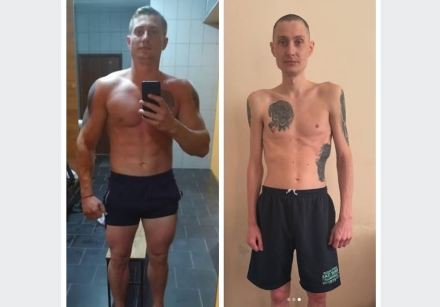 Transformarea dramatică a unui soldat ucrainean, care a pierdut 40 de kilograme în aproape trei ani de captivitate la ruși