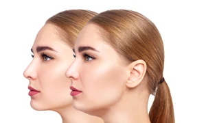 Exercitii pentru barbia dubla  Sursa foto shutterstock 2399863527 jpg