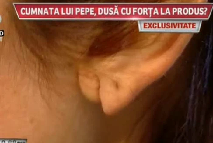 Femeia susţine că iubitul i-a sfârtecat urechea pentru că nu a făcut bani din prostituţie