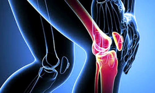 1 73023 original jpg jpeg