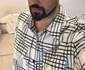 Alexandru Constantin și-a făcut implant de par de 3500 de euro