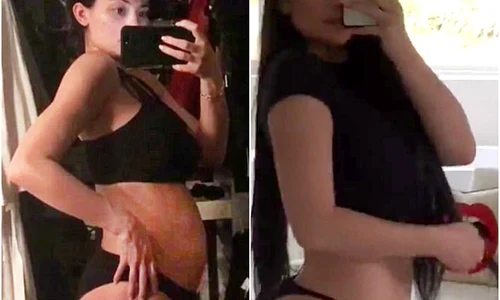 kylie jenner inainte dupa jpeg