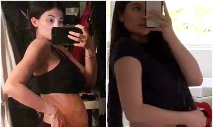 kylie jenner inainte dupa jpeg