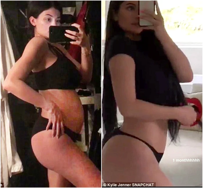 kylie jenner inainte dupa jpeg