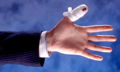 1 79598 original jpg jpeg