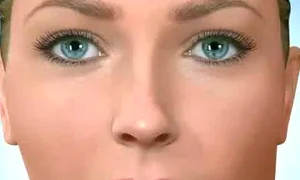 asimetrie faciala jpeg