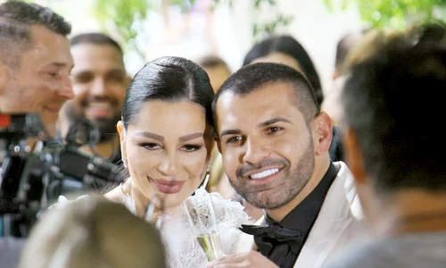 Pastramă și a sărutat aleasa și a zâmbit perfect cu fațete dentare de 5 000 € jpeg
