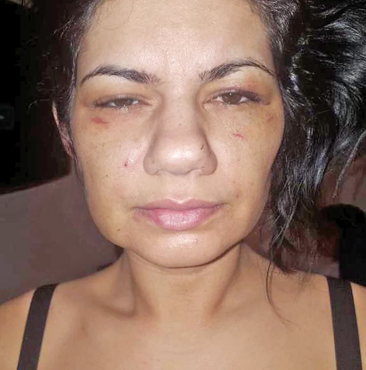 
    Georgiana Carmen  Bîrligea spune că  a fost maltratată  de fostul soț în mai  multe rânduri  