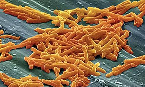klebsiellaklebsiella 0 jpeg