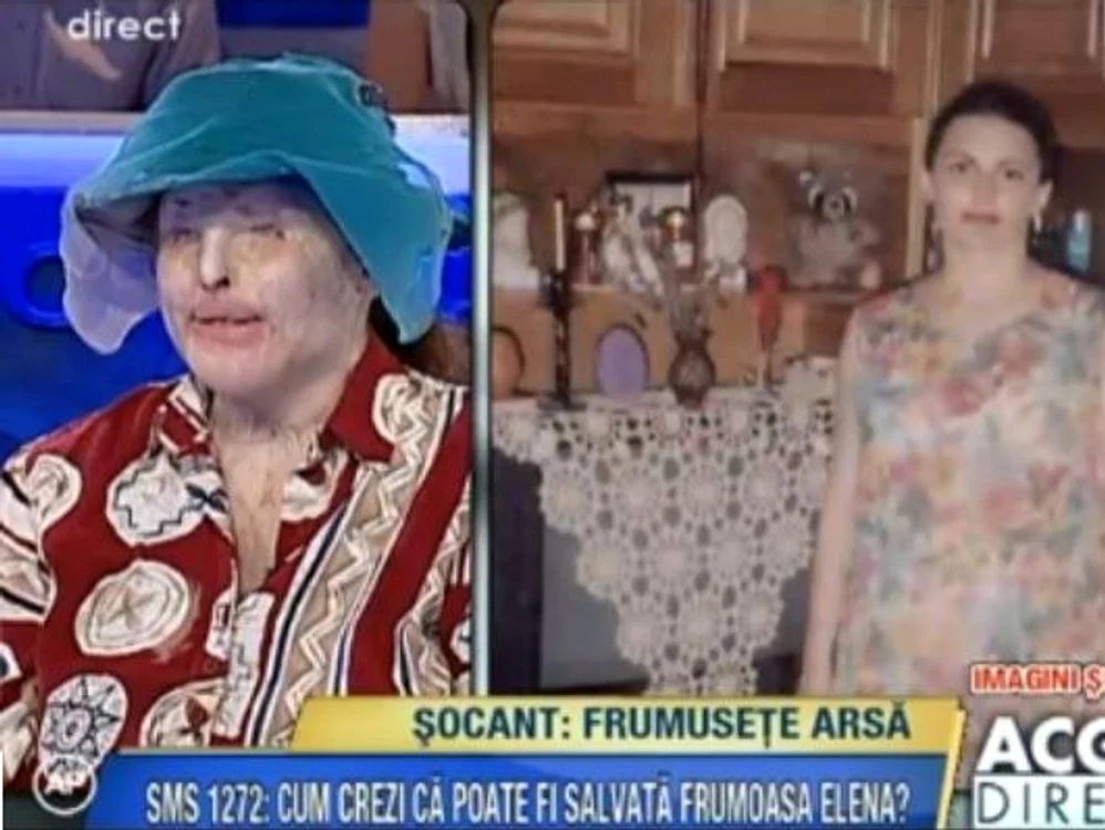 Elena a fost desfigurată FOTO: Acces Direct
