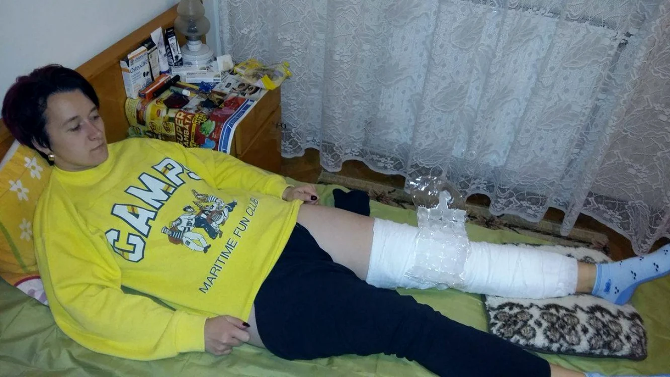 Cornelia Cochior, femeia accidentată de Dragoş Benea, nu a aflat din prima zi la Spitalul Judeţean de Urgenţe din Bacău că are piciorul fracturat