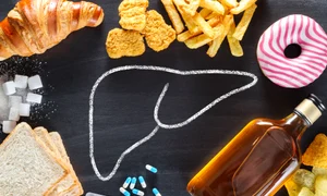 Alimente nocive pentru ficat FOTO Shutterstock jpg