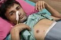 sachin linguri periute stomac india profimedia (2) jpg