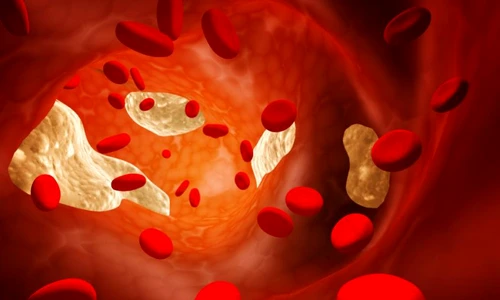 1 73206 original jpg jpeg