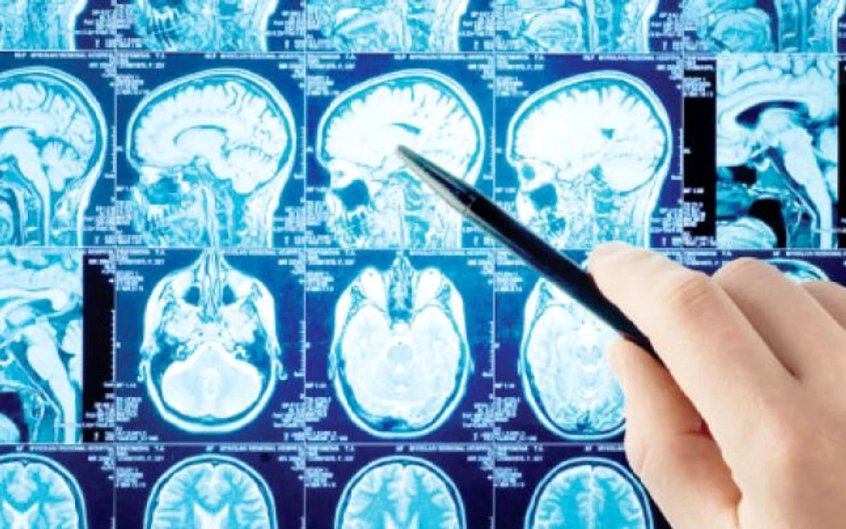 Oamenii de ştiinţă au descoperit zona creierului ce ne face să reacţionăm la situaţiile nedrepte  