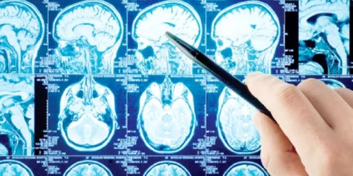 Oamenii de ştiinţă au descoperit zona creierului ce ne face să reacţionăm la situaţiile nedrepte  