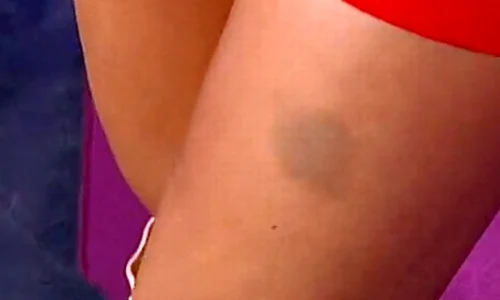 Elena a povestit cum s a ales cu ditamai vânătaia jpeg