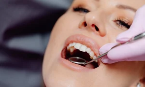 4 moduri in care sanatea orala influenteaza starea de bine jpg