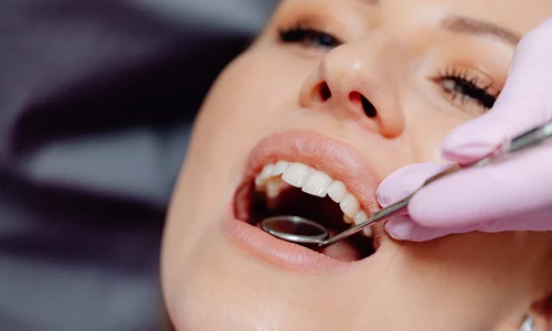 4 moduri in care sanatea orala influenteaza starea de bine jpg