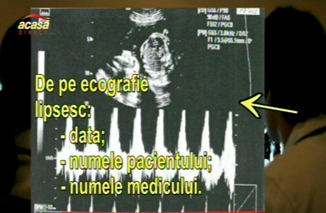 actte