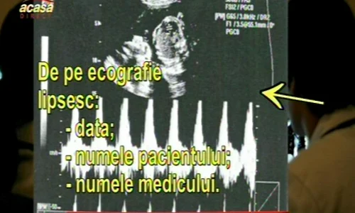 actte jpeg