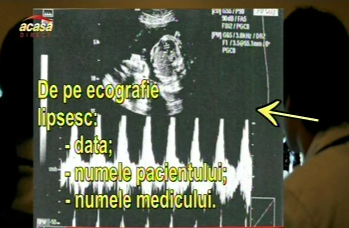 actte