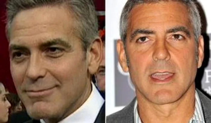 george clooney operatie estetica