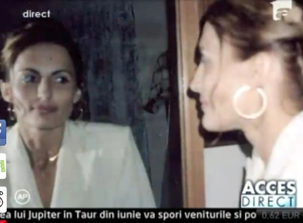 Elena a fost desfigurată FOTO: Acces Direct