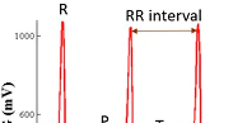 Fig. 1 Electrocardiogramă