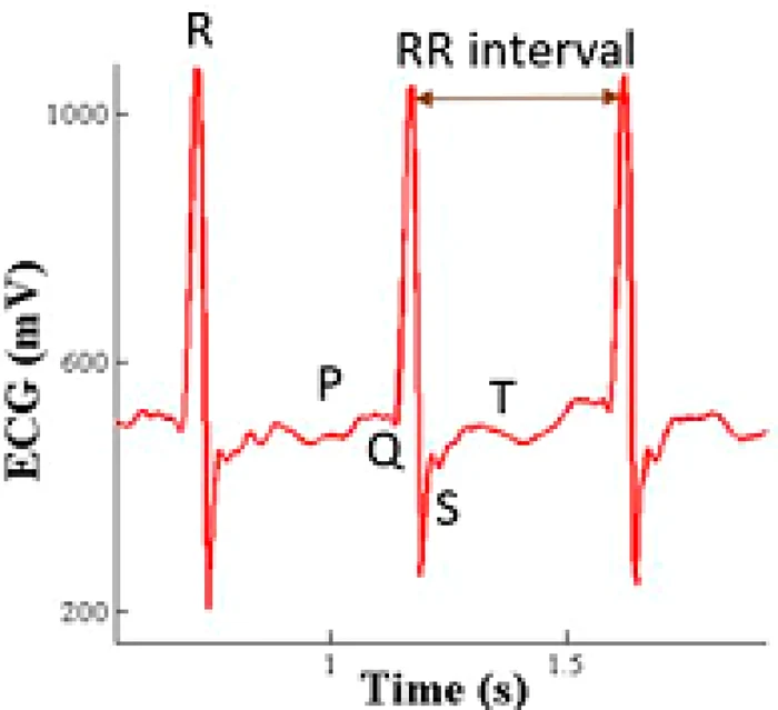 Fig. 1 Electrocardiogramă