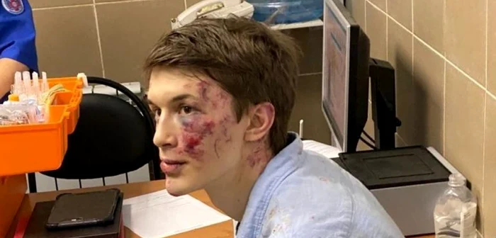 Presa rusă scrie că Jukov a mai fost ţinta unui atac similar pe 27 iulie. Atunci, acesta a reuşit să fugă de câţiva indivizi cu cagule pe cap.