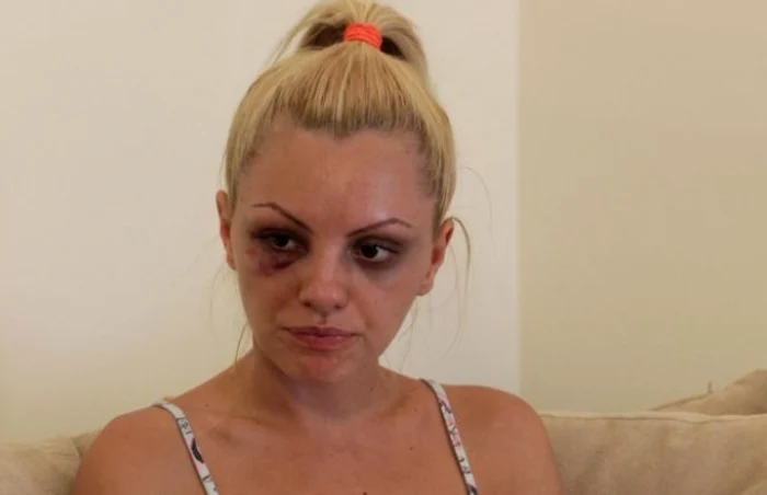 Alexandra Stan (26 de ani), bătută de fostul impresar