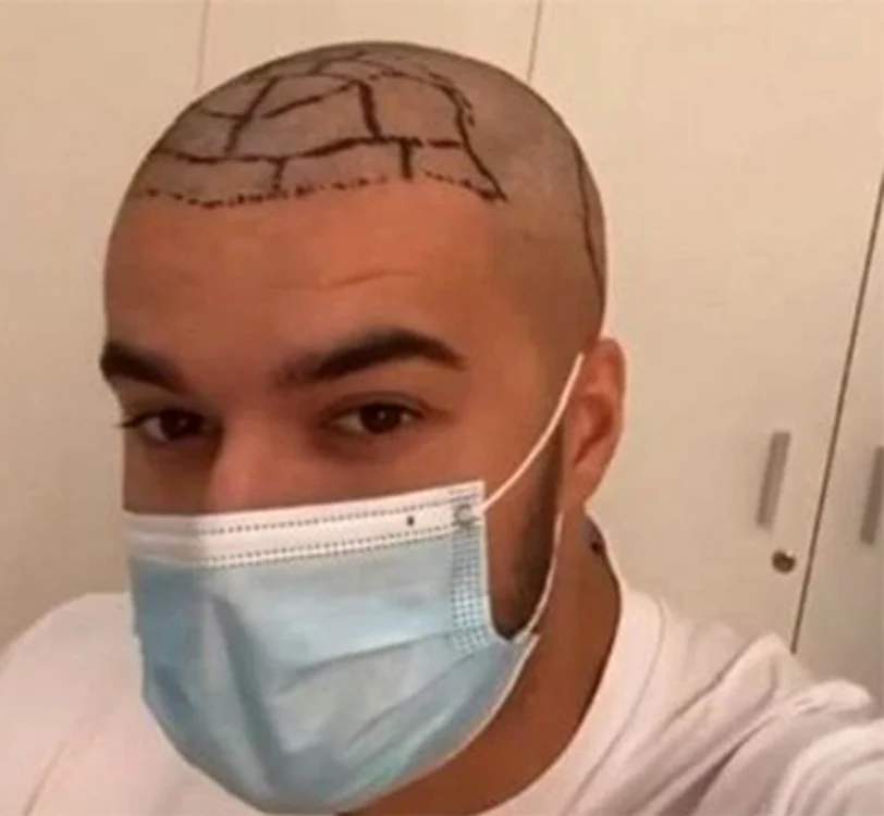 Culiţă Sterp, cu doctorul lui: ”Mi-a pus 3.500 de fire!”