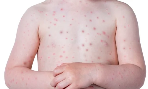 1 shutterstock 1090804772 jpg jpeg