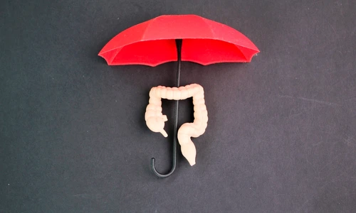 cancer colorectal shutterstock 2474044929 jpg