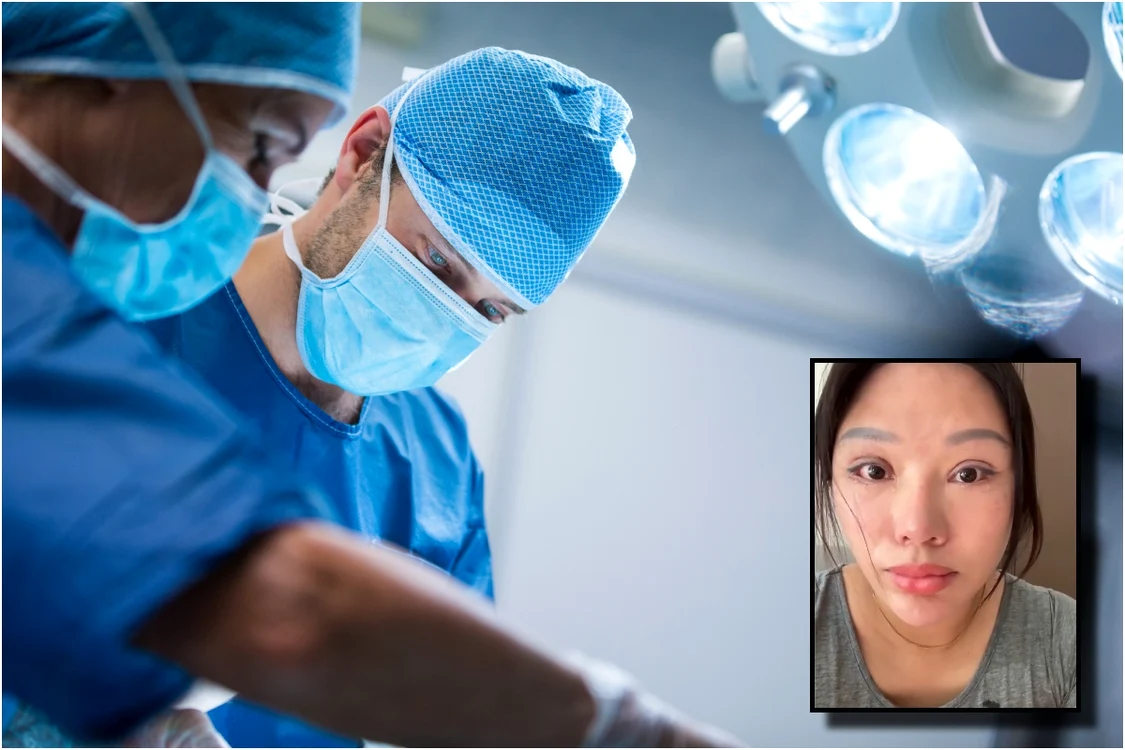 Intervenția estetică ce s-a transformat într-un coșmar pentru o femeie. Foto: magnific.com/scmp.com