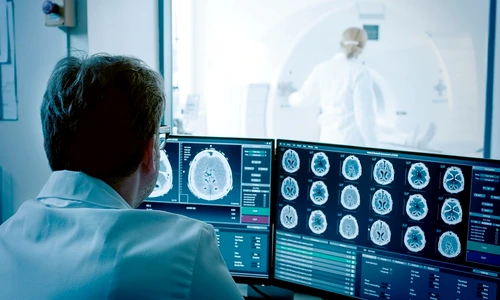 1 tromboliza jpg jpeg