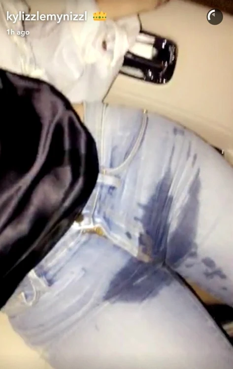Kylie a arătat pe Snapchat ce a pățit