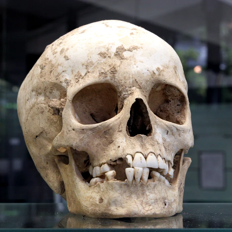 Craniu din neolitic