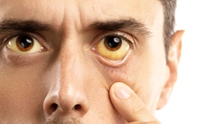 ochi_galbeni_icter_shutterstock 1186032016 jpg